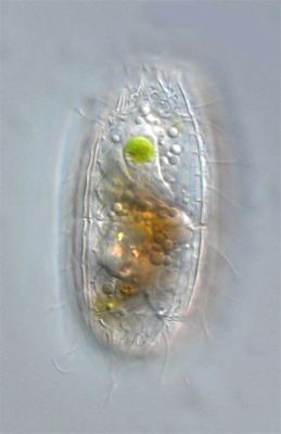  Coleps!  A Tiny but Mighty Ciliate Dancing Through Freshwater