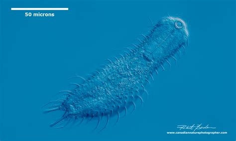  Gastrotrichs กินตัวเล็กๆ สุดยอด!  