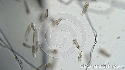  Paramecium!  A Microscopic Marvel That Swims Like a Tiny Speedboat