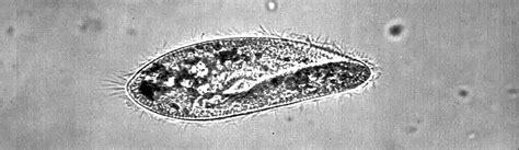  Paramecium! A Tiny Hair-Covered Swimmer That Defies Expectations With Its Complex Inner Workings